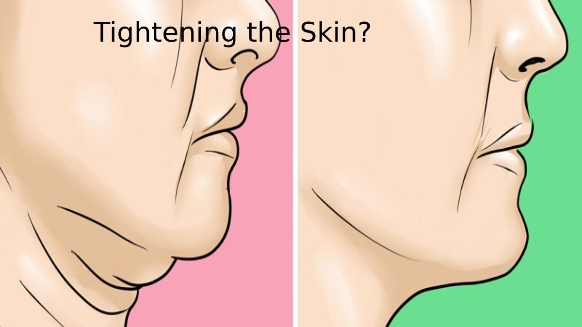 Tightening the Skin?