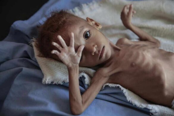 starvation