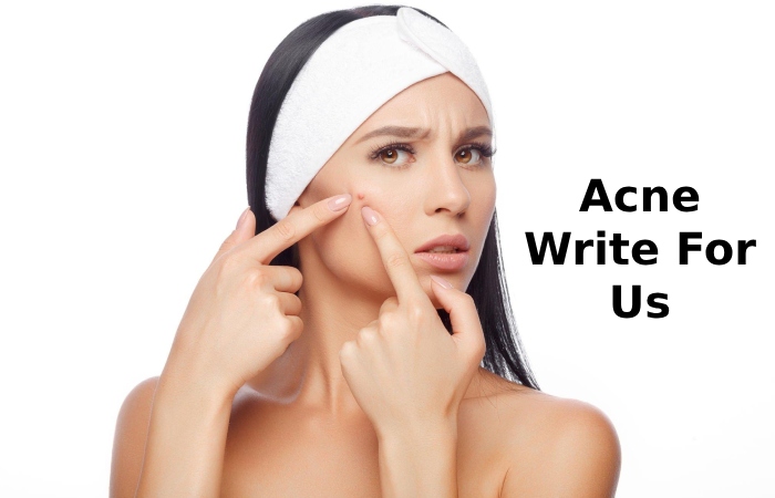 Acne Write For Us